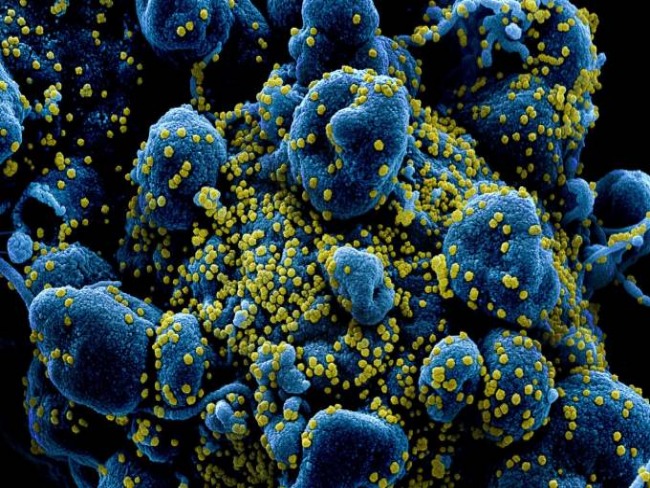 Coronavírus: Nova York tem recorde de mortes em 24 horas, com 630 mortes