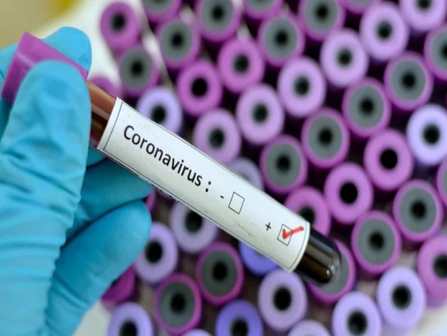 Estado confirma mais 3 mortes por coronavrus em MS