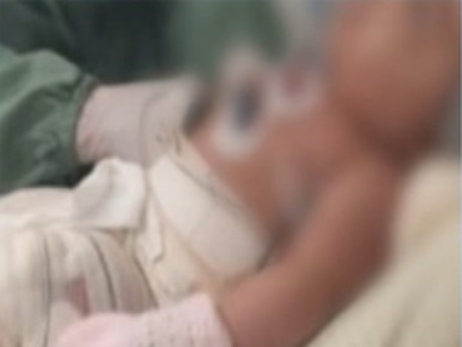 Laudo confirma que queimadura foi a causa da morte de bebê em Niterói