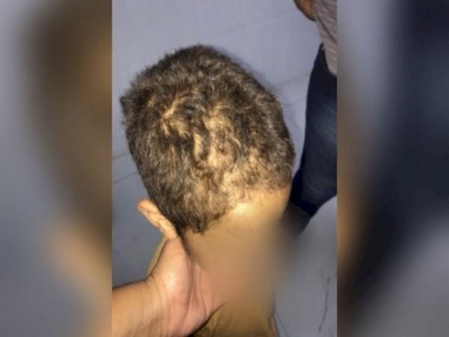  Pai e madrasta so presos por torturar criana de 7 anos em Gois
