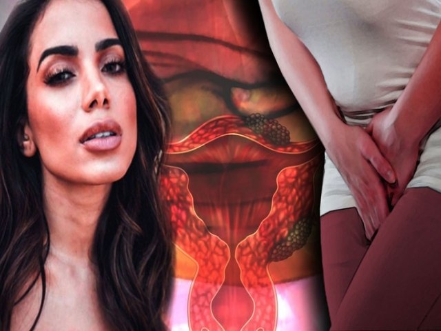 Endometriose: entenda sintomas e tratamento da doena de Anitta