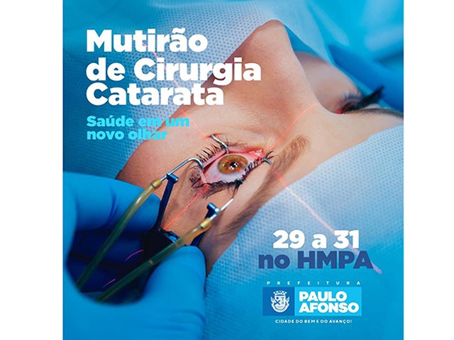 Mutirão de Catarata realiza 850 cirurgias no HMPA de 29 a 31 de outubro