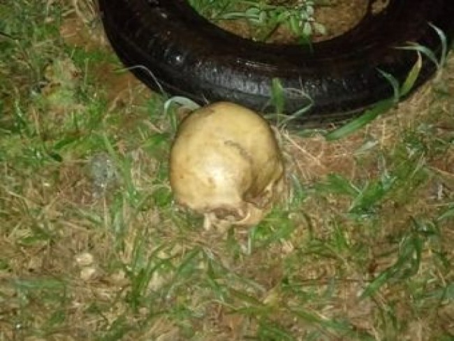 Agricultor encontra crnio humano no quintal de casa em Chapec
