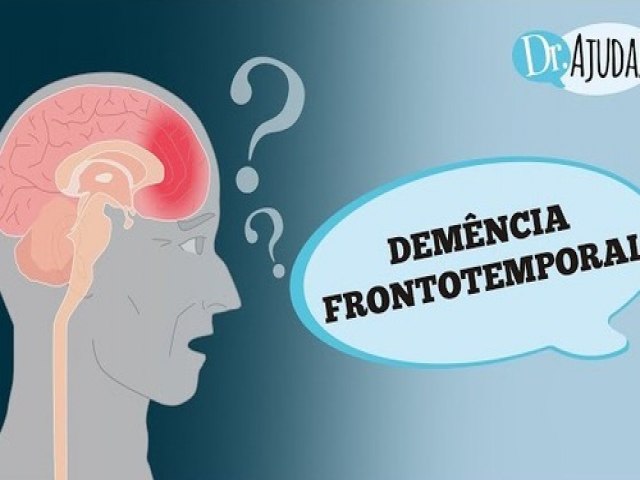 Voc sabe o que  demncia frontotemporal ?