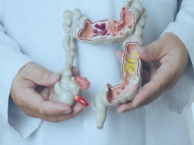 Inflama��o causa c�ncer? Entenda riscos silenciosos e como prevenir