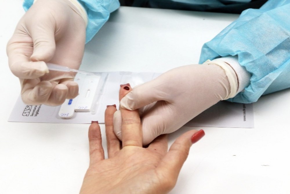 Luta contra o HIV: SCS recebe testagem r�pida na segunda-feira