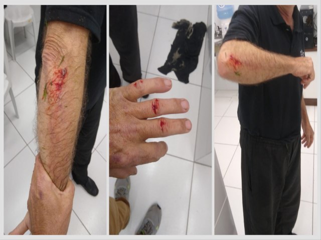 Vigilante de prefeitura  agredido durante o horrio de trabalho