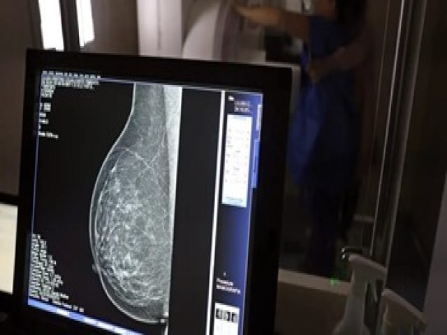 Cerca de 77 mil mulheres aguardam mamografia pelo SUS