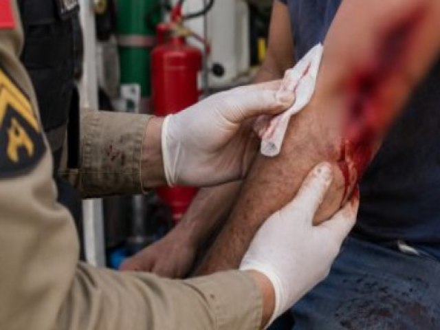 Golpe de canivete no bra�o provoca choque hemorr�gico e leva homem �s pressas para cirurgia em Treze de Maio