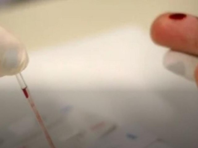 Nova variante do HIV  identificada em circulao em trs Estados do Brasil, revela estudo